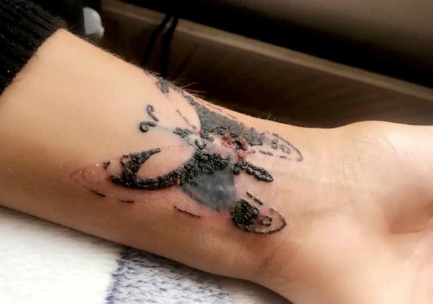 Areas de trabalho que nao aceitam tatuagem Jovem Faz Tatuagem Com Profissional Sem Licenca E Fica Sem Mexer O Braco Revista Glamour Lifestyle