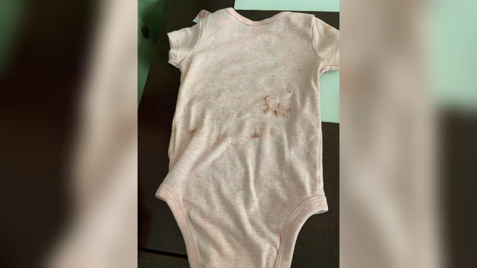 Roupa de criança ensanguentada após cair em creche, em Taguatinga, no DF  — Foto: Arquivo pessoal 