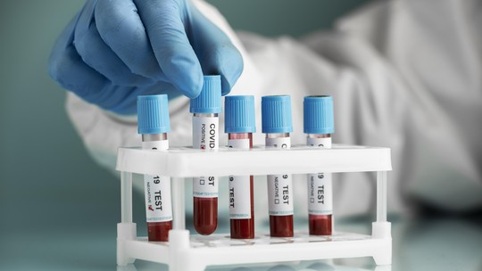 Amostras de bancos de sangue mostram evolução de epidemias, diz estudo no Brasil; entenda