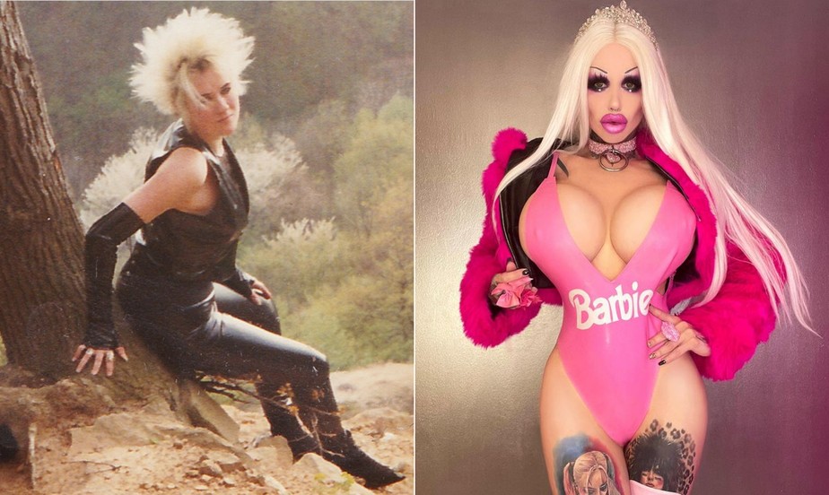 Brigitte já se submeteu a muitas plásticas para mudar sua aparência