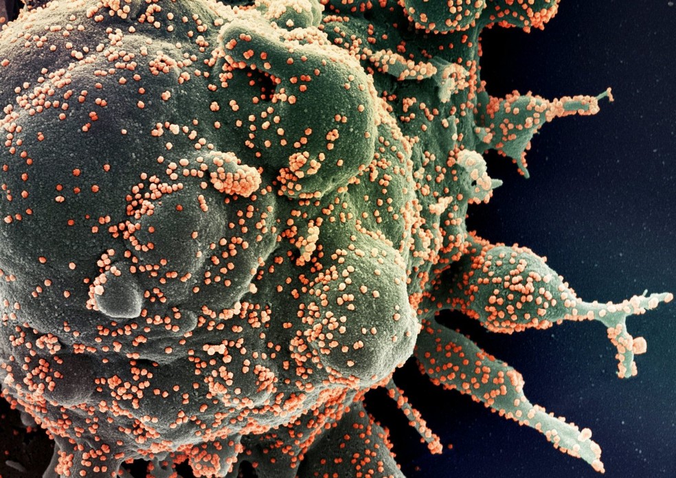 Foto microscópica mostra célula humana sendo infectada pelo Sars Cov-2, o novo coronavírus — Foto: NIAID via Nasa