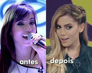 Anitta antes e depois da cirurgia! (Foto: Mais Você / TV Globo)