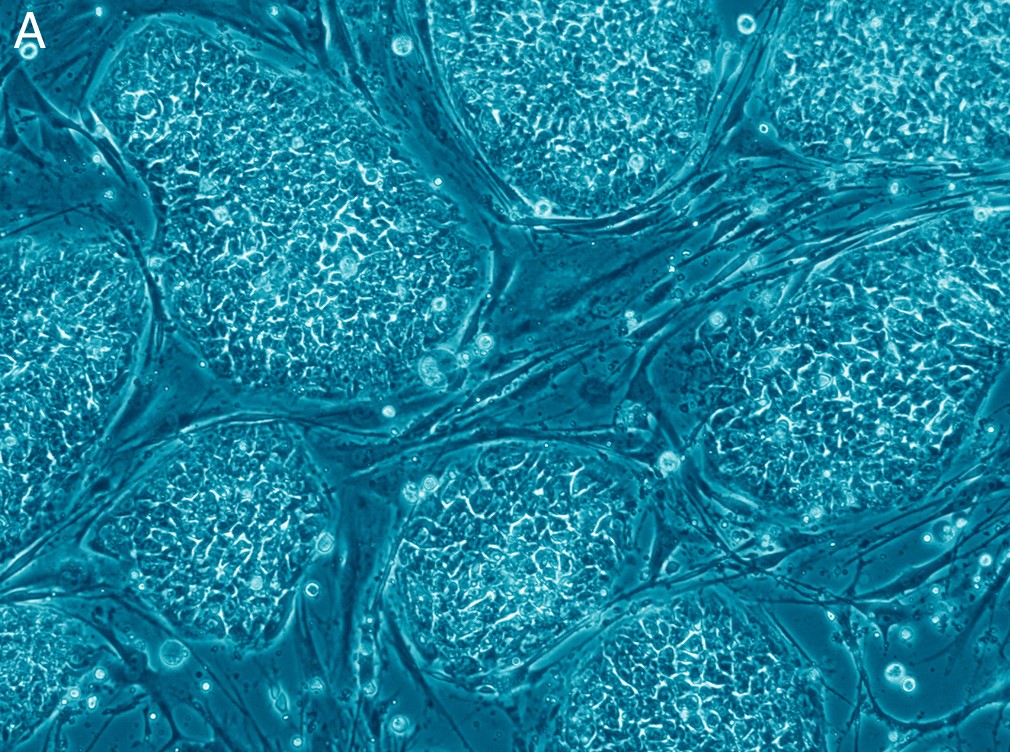 Imagem de um conjunto de células humanas (Foto: Wikimedia Commons)