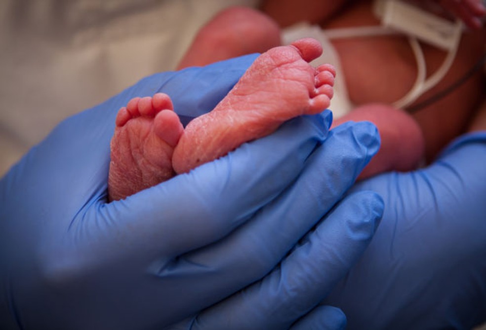 Médico segura pés de bebê recé-nascido (Foto: Hospital da Universidade de Utah/AP)