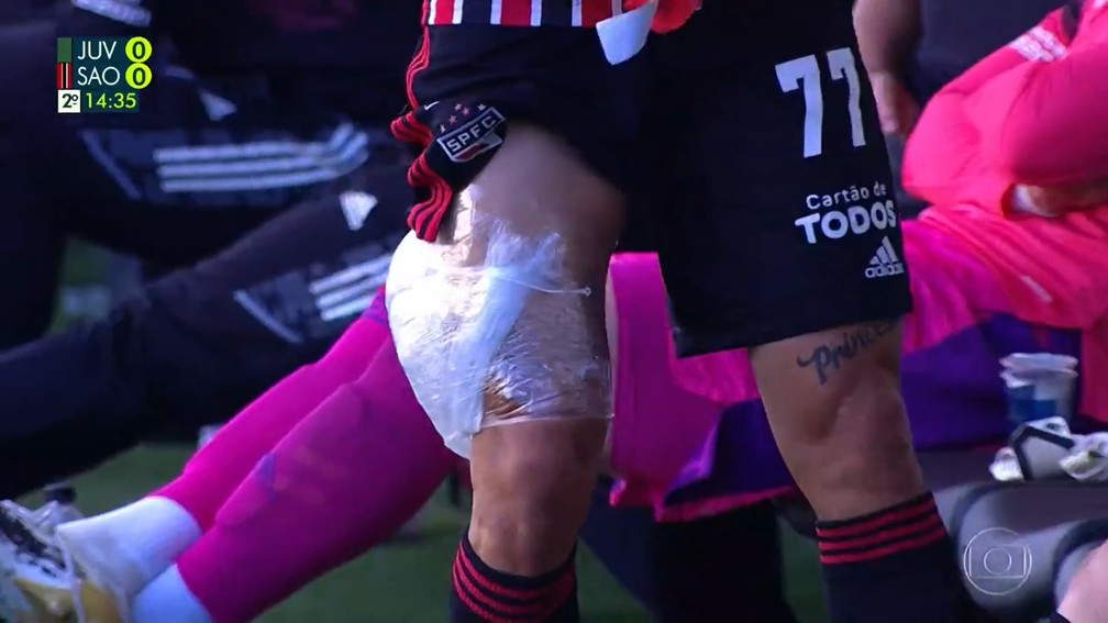 Preocupa? Rigoni é substituído e inicia tratamento na coxa direita ainda no banco de reservas