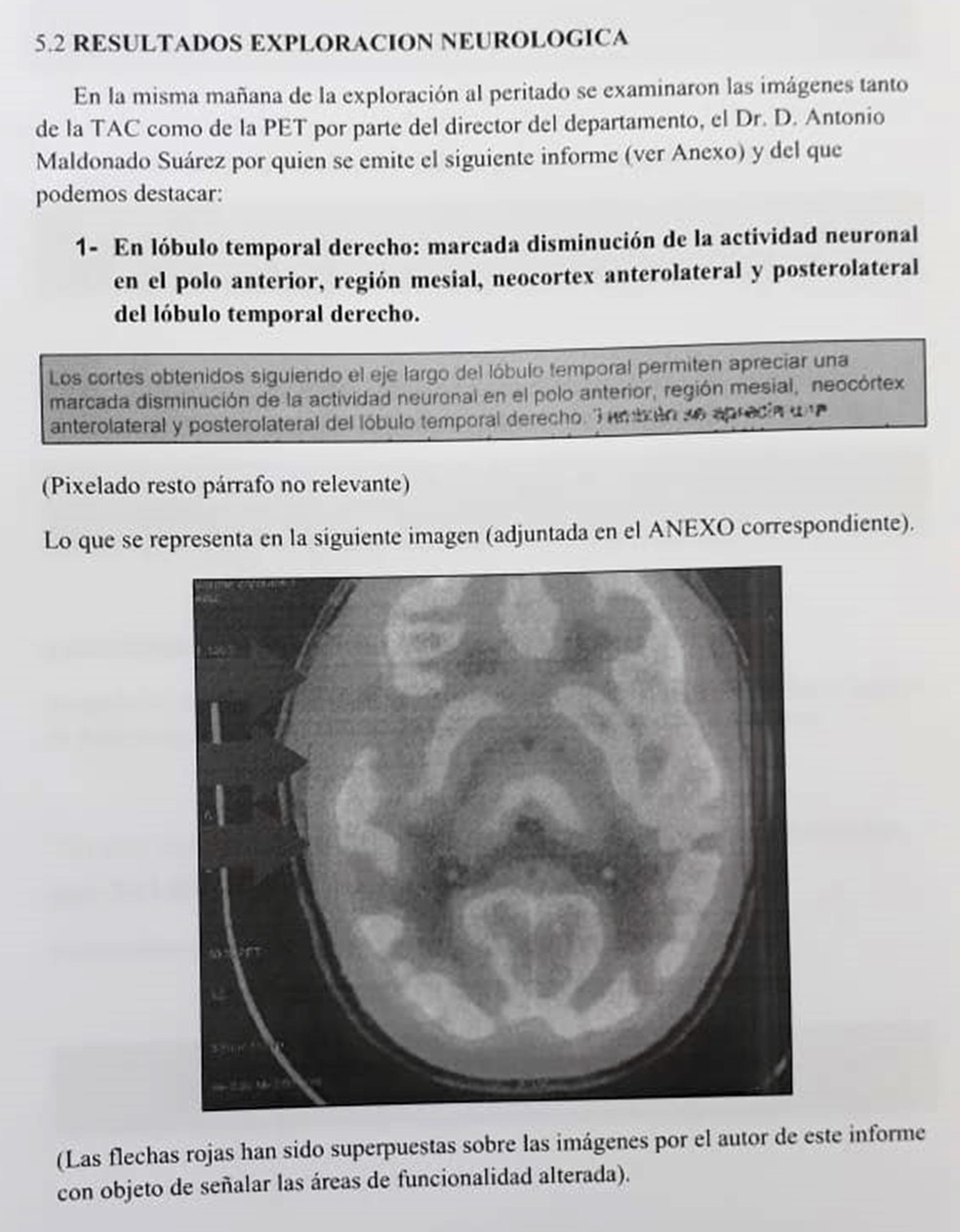 Perícia neurológica de imagens apontou anomalias em área do cérebro de Patrick Gouveia — Foto: Reprodução