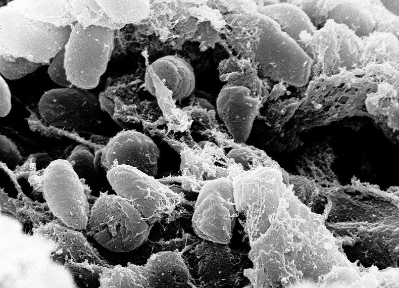 A bactéria Yersinia pestis (Foto: Wikimedia Commons)