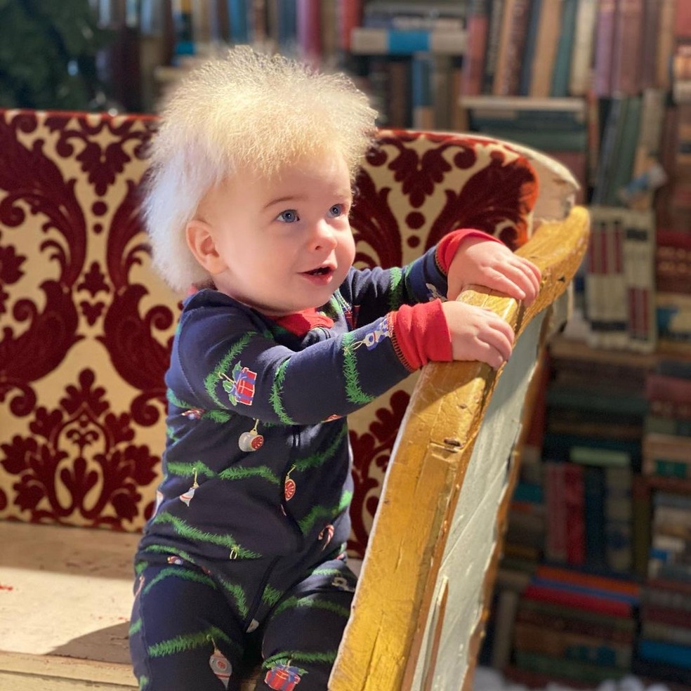 Locklan Samples foi diagnosticado com 'síndrome do cabelo impenteável' aos 10 meses — Foto: Reprodução/Instagram