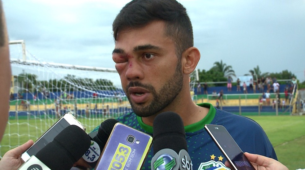 Após chute no rosto, Humberto relata ter "apagado" em campo — Foto: Pablo Silva/TV Clube