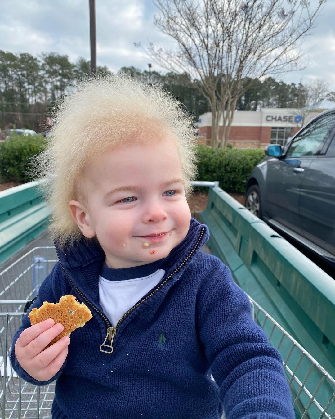 Menino com â€˜sÃ­ndrome do cabelo impenteÃ¡velâ€™ faz sucesso nas redes sociais; veja fotos