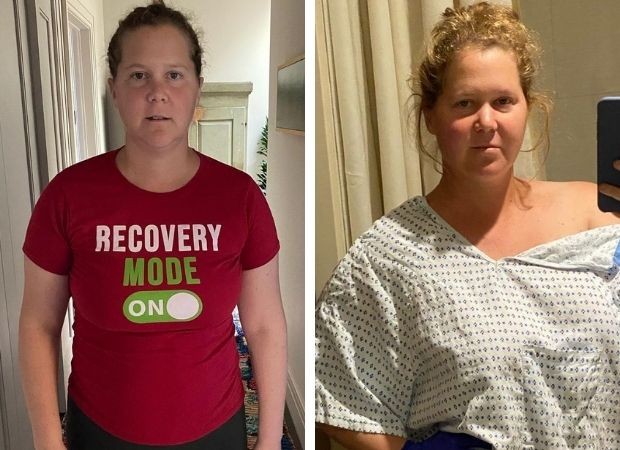Amy Schumer retirou o apêndice após descobrir tumor e passou por histerectomia (Foto: Reprodução/Instagram)
