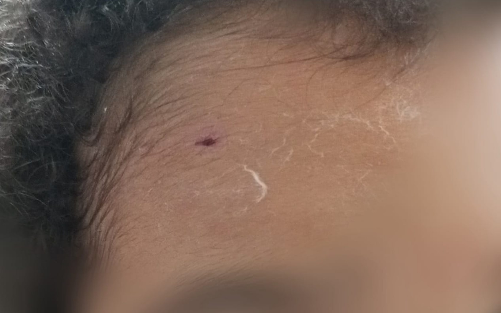 Pitbull ataca mãe e filho dentro de petshop em shopping de Ribeirão Preto, SP, diz família