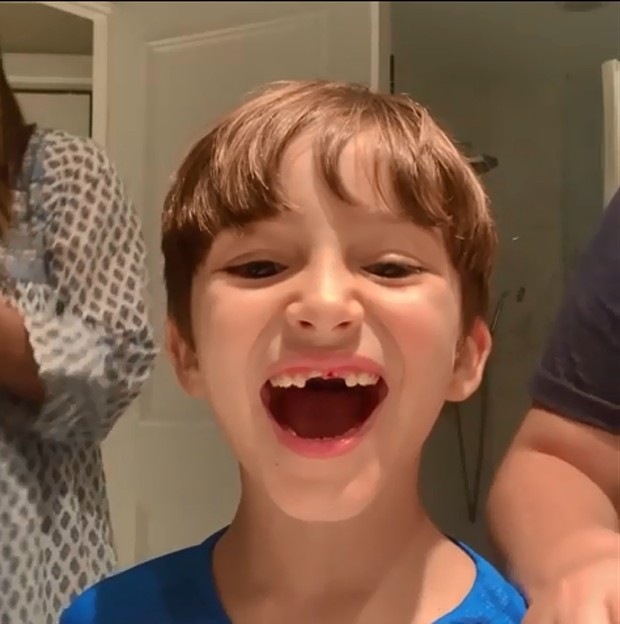 Claudia Leitte arranca dente de filho (Foto: Reprodução/Instagram)