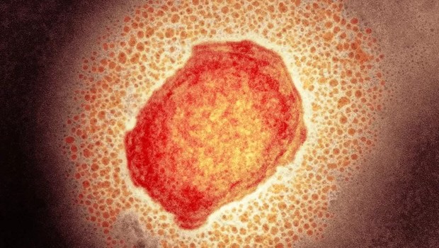 Partícula do vírus da varíola de macaco (Foto: Science Photo Library via BBC)