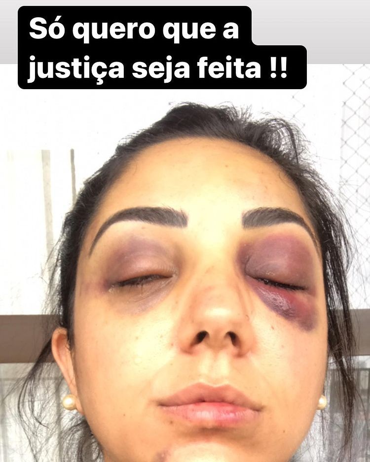 Vítima de agressão pede prisão preventiva  (Foto: Reprodução: Instagram)