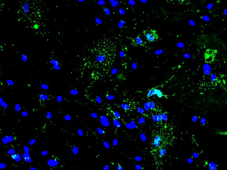 Sars-CoV-2 aumenta gasto energético de células do cérebro para se replicar. Constatação foi feita por meio de experimentos feitos com hamsters e com astrócitos isolados dos roedores (proteína spike do SARS-CoV 2 em verde e, em azul, os núcleos dos astrócitos). (Foto: Lilian Gomes de Oliveira e Yan de Souza Angelo/ICB-USP)