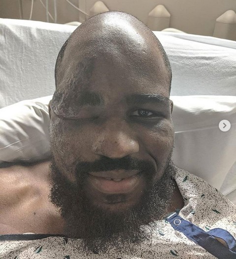 O lutador Corey Anderson em um leito hospitalar após sofrer um acidente de bicicleta (Foto: Instagram)
