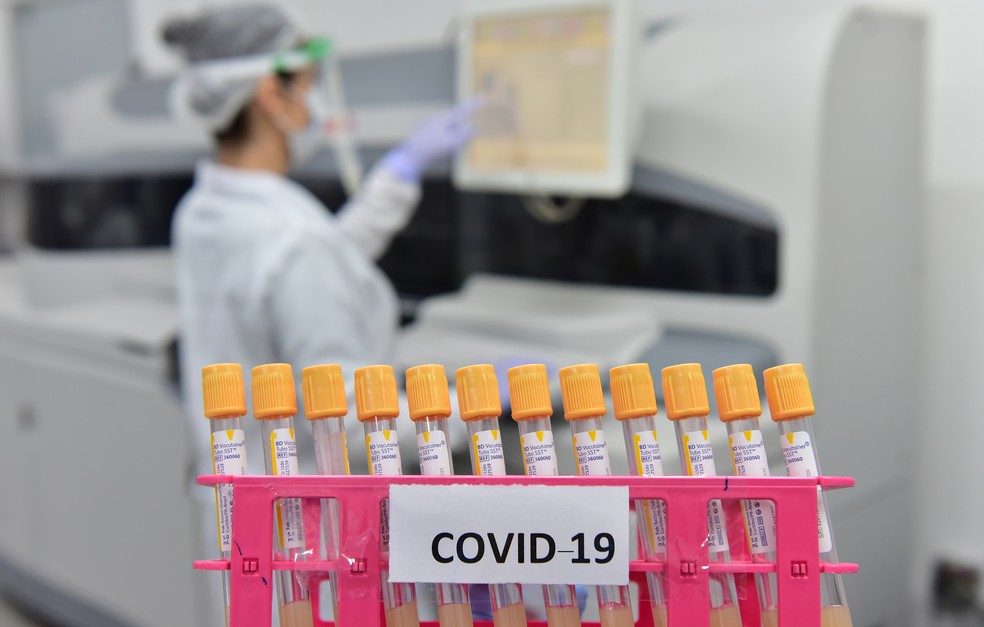 Equipamento automatizado para pesquisa de anticorpos contra o vírus SARS-CoV-2 (Covid-19) e outras análises — Foto: Ector Gervasoni 
