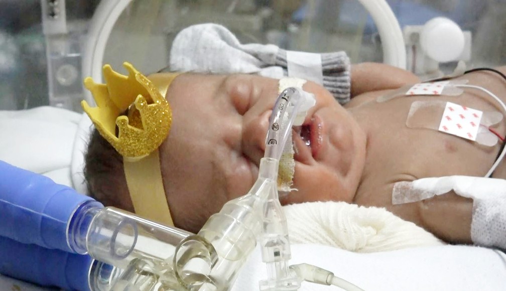 Vestido como Menino Jesus, bebê da UTI neonatal emocionou a mãe, em surpresa preparada pela equipe médica — Foto: Letícia Paris/g1