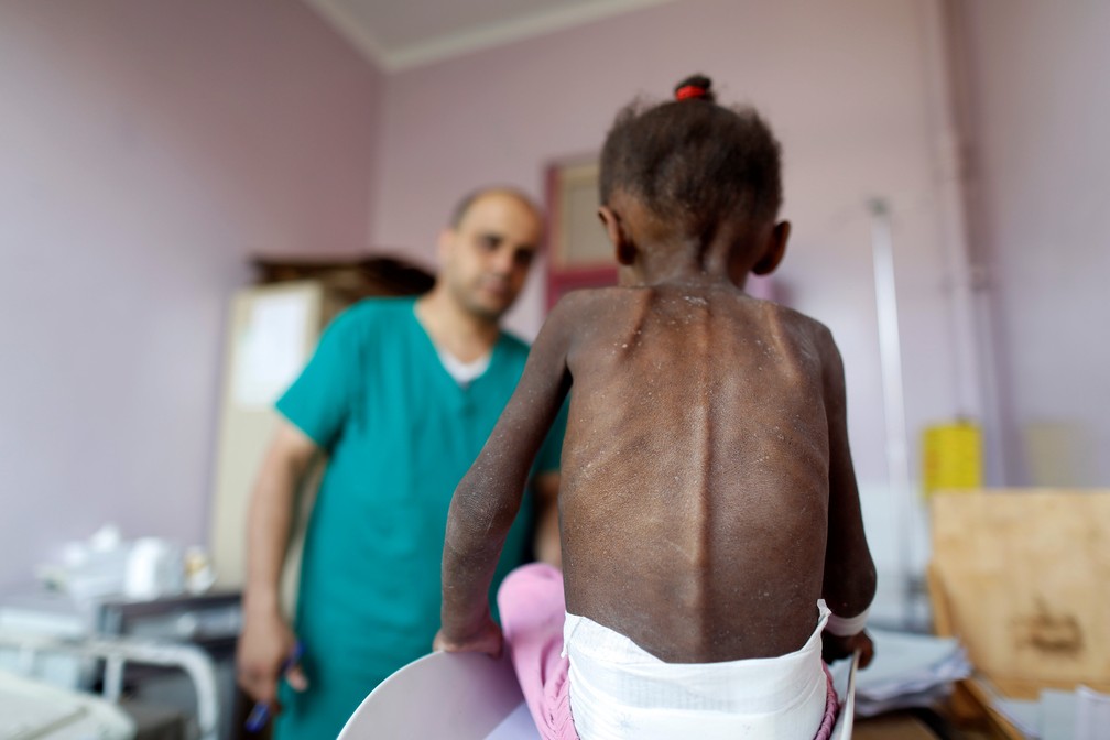 Enfermeiro pesa menina desnutrida no IÃªmen â Foto: REUTERS/Khaled Abdullah