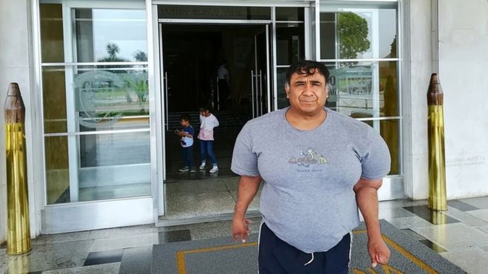 Alejandro Ramos, o 'Willy', convive com seu corpo inchado há quatro anos (Foto: Feliciano Herrera)