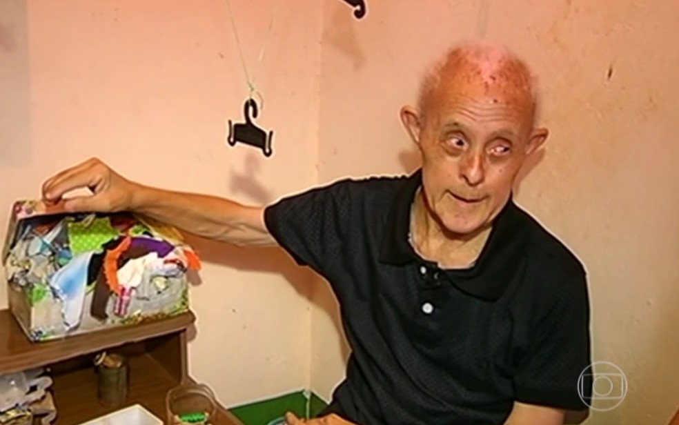 JoÃ£o Batista Ã© o idoso mais velho com SÃ­ndrome de Down no Brasil â€” Foto: ReproduÃ§Ã£o/TV Globo
