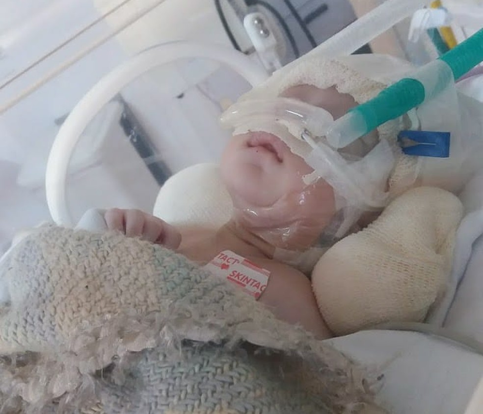 Bebê de 3 meses luta pela vida após parada cardiorrespiratória de 20 minutos — Foto: Arquivo Pessoal