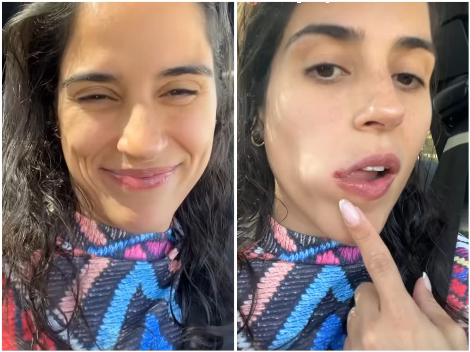 Camilla Camargo mostra herpes labial (Foto: Reprodução/Instagram)