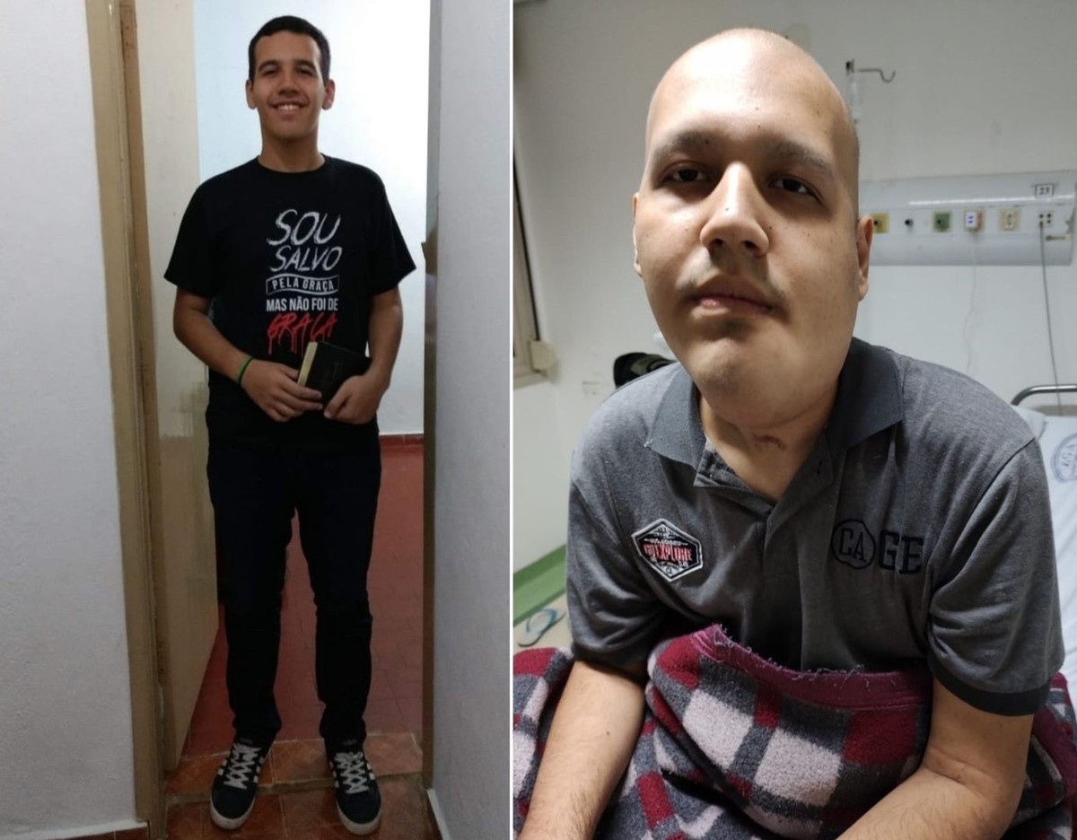 Jovem Com Câncer Raro Na Mandíbula Aguarda Vaga Para Realizar Cirurgia Luta Contra O Tempo 4973