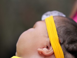 Bebê com microcefalia (Foto: Aldo Carneiro/Pernambuco Press)