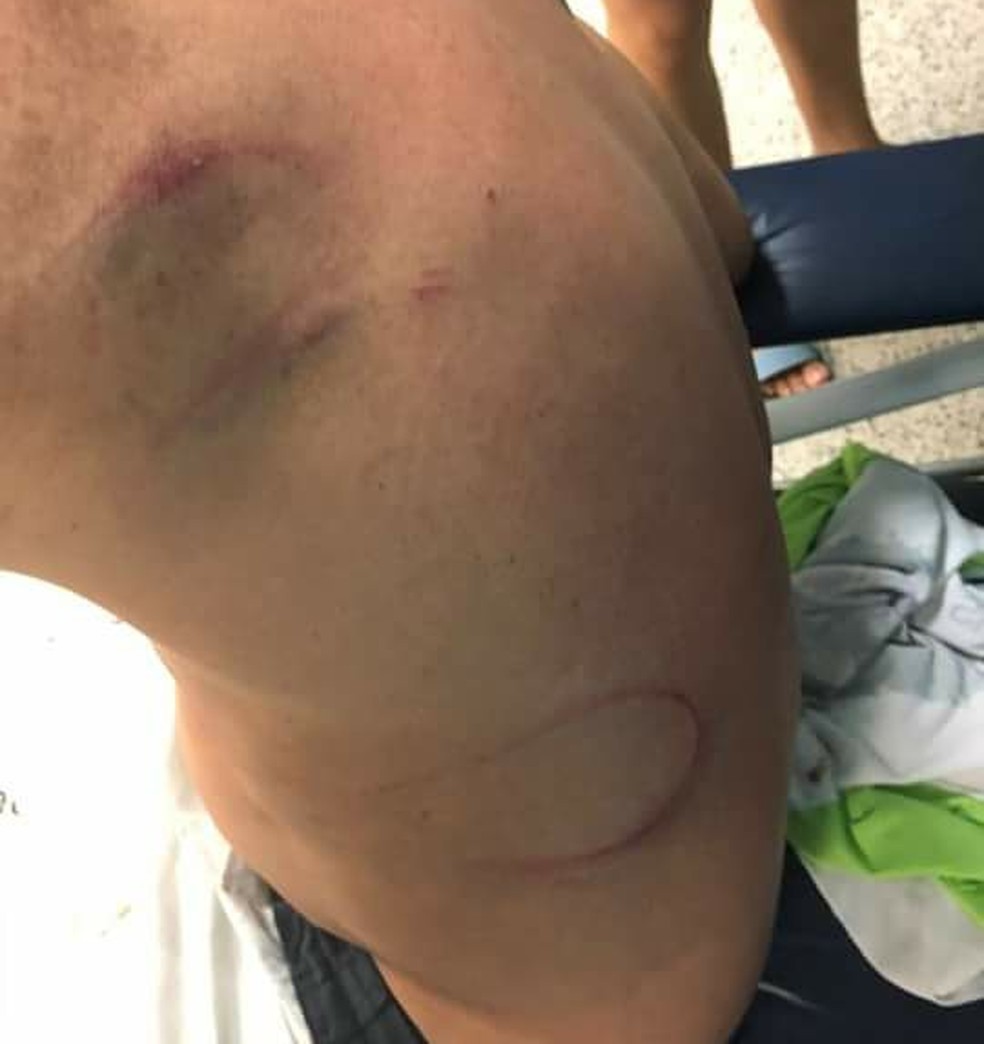 Vigilante foi agredido no Paço Municipal de Cubatão, SP (Foto: Arquivo Pessoal)