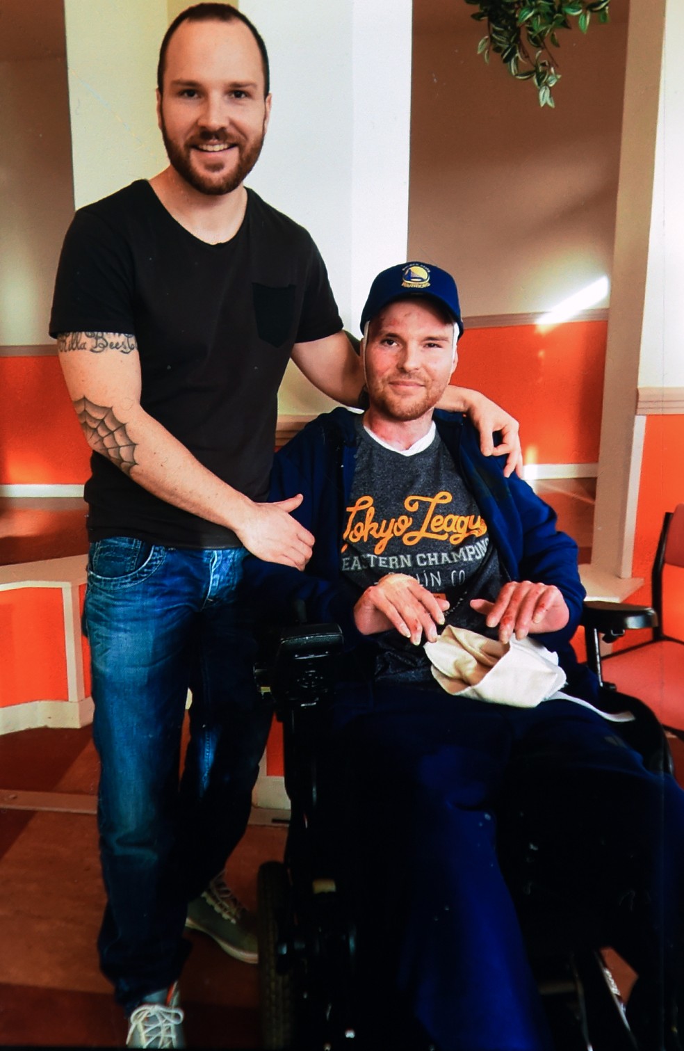 Franck ao lado do irm�o g�meo, Eric, doador do transplante de pele (Foto: Arquivo pessoal da fam�lia/AFP)