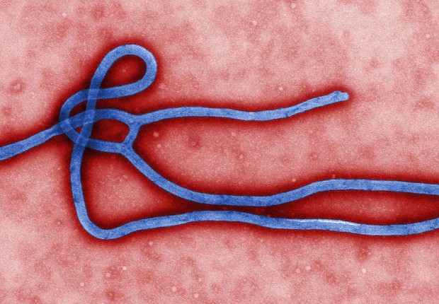 Vírus ebola (Foto: Microbiologist Cynthia Goldsmith)