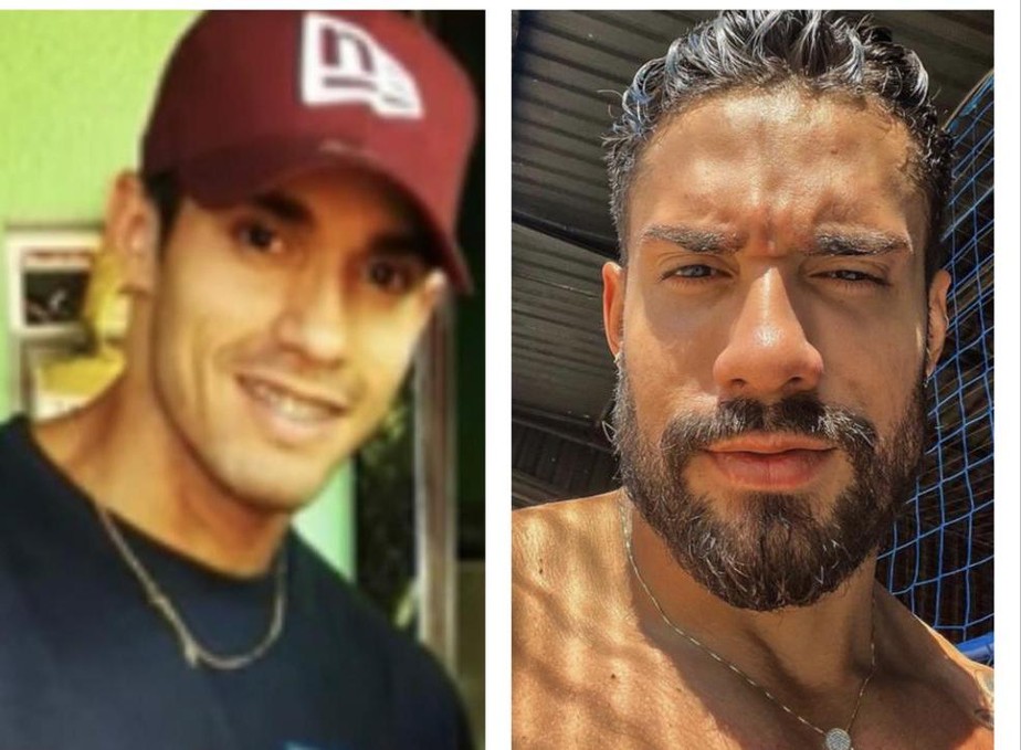 Bil Araújo antes e depois da harmonização facial