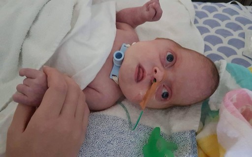 Pais de bebê com síndrome rara fazem vaquinha online para ...