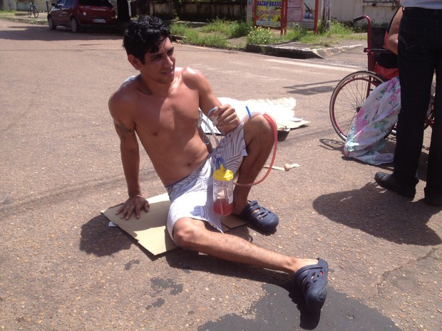 Diego Potter, de 28 anos, utiliza sonda para atendimendo no HE, em Macapá  (Foto: John Pacheco/G1)