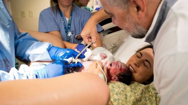 Para brasileiras que recorreram ao programa em Miami como Aline Villa, uma das maiores dificuldades foi lidar com as consultas médicas nos EUA (Foto: BBC News)