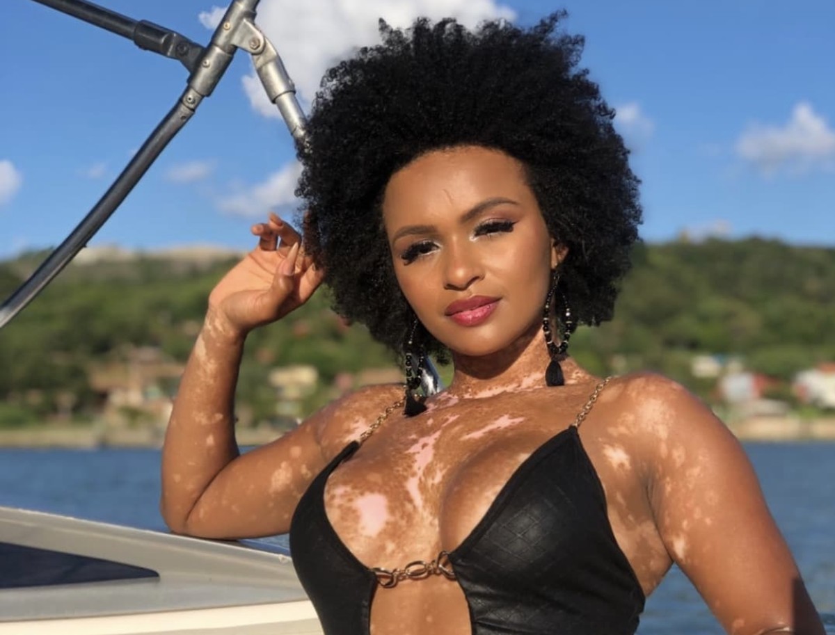 Equipe de Natália denuncia à polícia ataques racistas;  ex-BBB foi chamada de ‘dálmata’ por ter vitiligo |  Minas Gerais