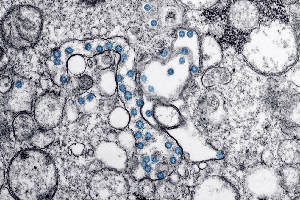 Coronavirus Tire Suas Duvidas Sobre A Pesquisa De Medicamentos No Combate A Covid 19 Coronavirus G1