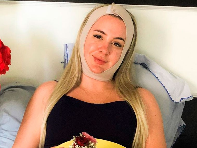 Patrícia Leitte pós bichectomia e lipoaspiração na papada (Foto: Reprodução/Instagram)