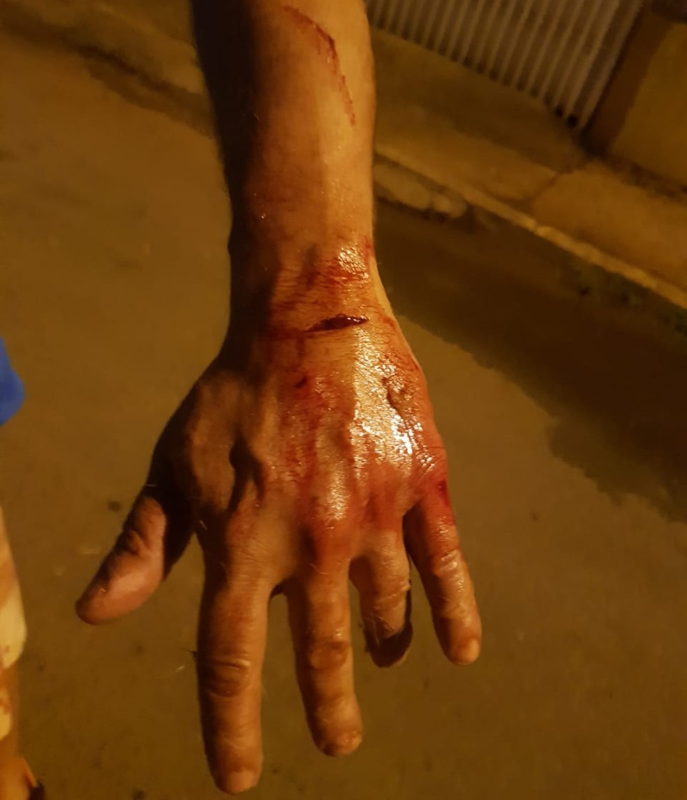 Homem ficou ferido após ataque de cachorro — Foto: Arquivo pessoal
