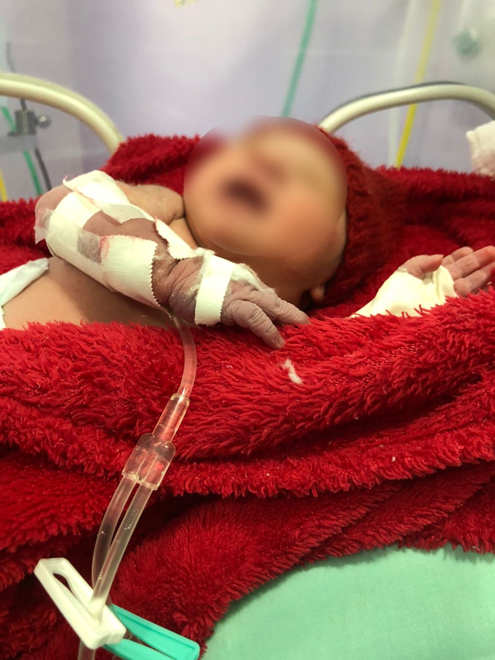 Após convulsão, jovem teve que passar por um parto de emergência — Foto: Arquivo Pessoal