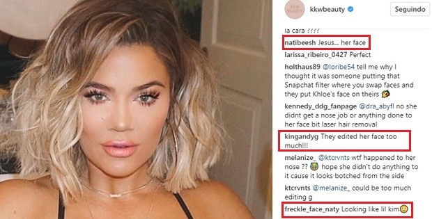 Fãs reagem a rosto modificado de Khoé Kardashian (Foto: Reprodução/Instagram)