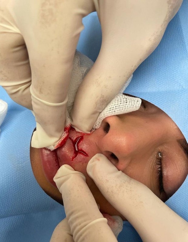 Silvye Alves foi submetida à cirurgia na boca após agressão do ex (Foto: Reprodução/Instagram)