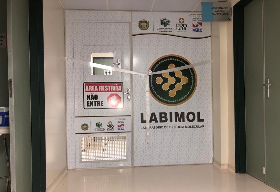 Santarém vai realizar exame PCR, no Labimol — Foto: Kamila Andrade/G1