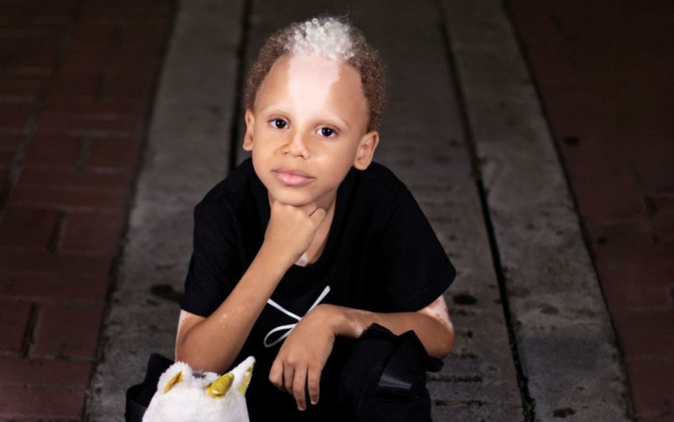O baiano Samuel Purificação tem 5 anos e uma condição genética rara — Foto: Arquivo pessoal