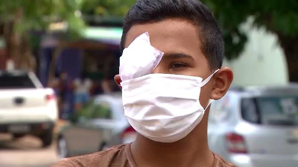 Adolescente é atingido por bala de borracha no olho durante manifestação no Amapá; PM investiga — Foto: Rede Amazônica/Reprodução