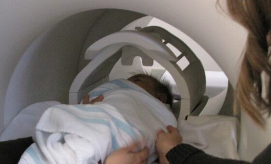 Bebê dormindo antes da ressonância magnética  (Foto: CIDD/ Universidade da Carolina do Norte )