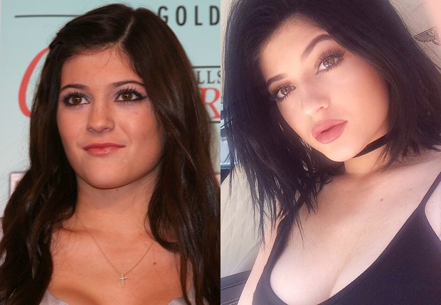 Kylie Jenner em 2010 e em 2014 (Foto: getty Images e Reprodução/Instagram)