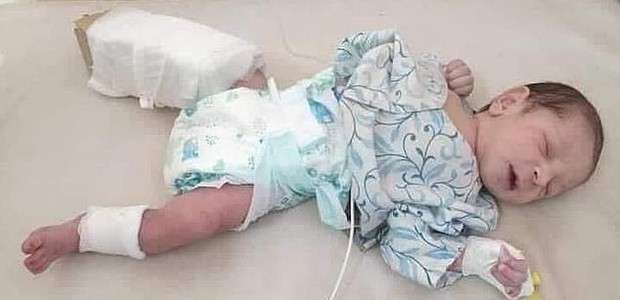Bebê que levou dois tiros durante atentado no Afeganistão sobrevive após cirurgia (Foto: Reprodução/Daily Mail)